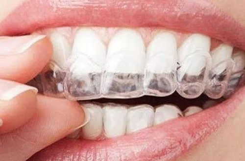 Choosing The Right Orthodontist For Your Dental Treatment